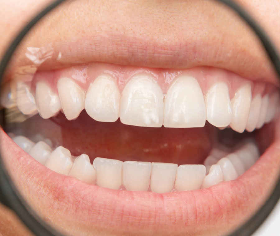 Benefits of Early Gum Treatment